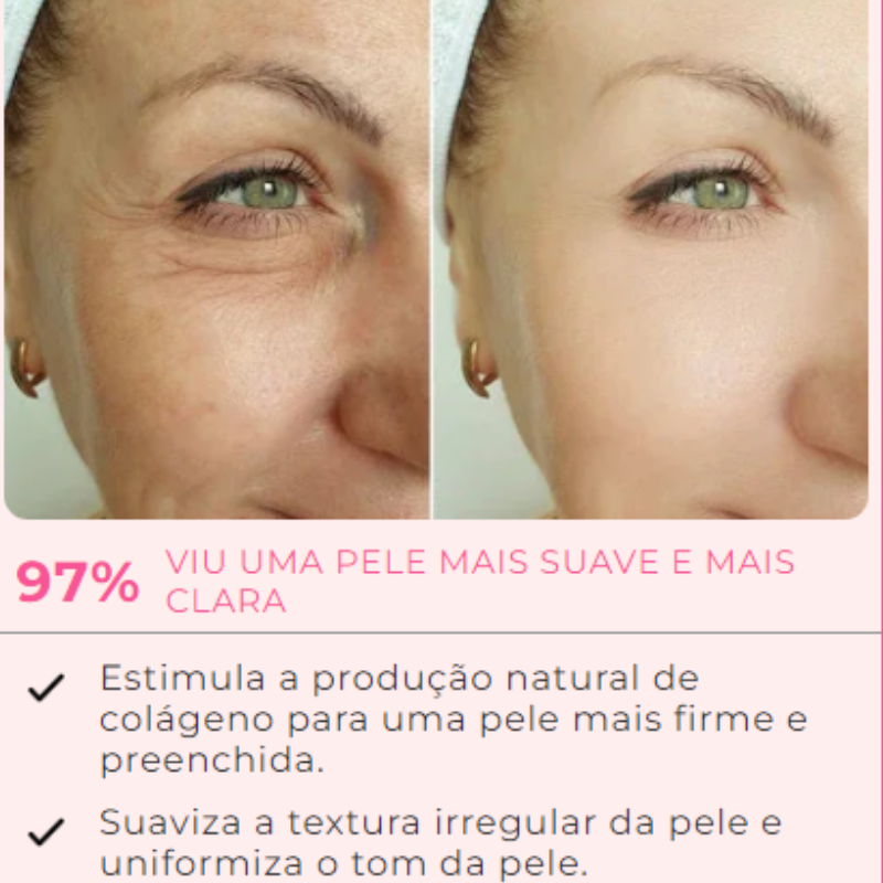 KIT RENEW 7 AMPOLAS + 1 APLICADOR DE BRINDE -  EFEITO BOTOX | Frete Grátis