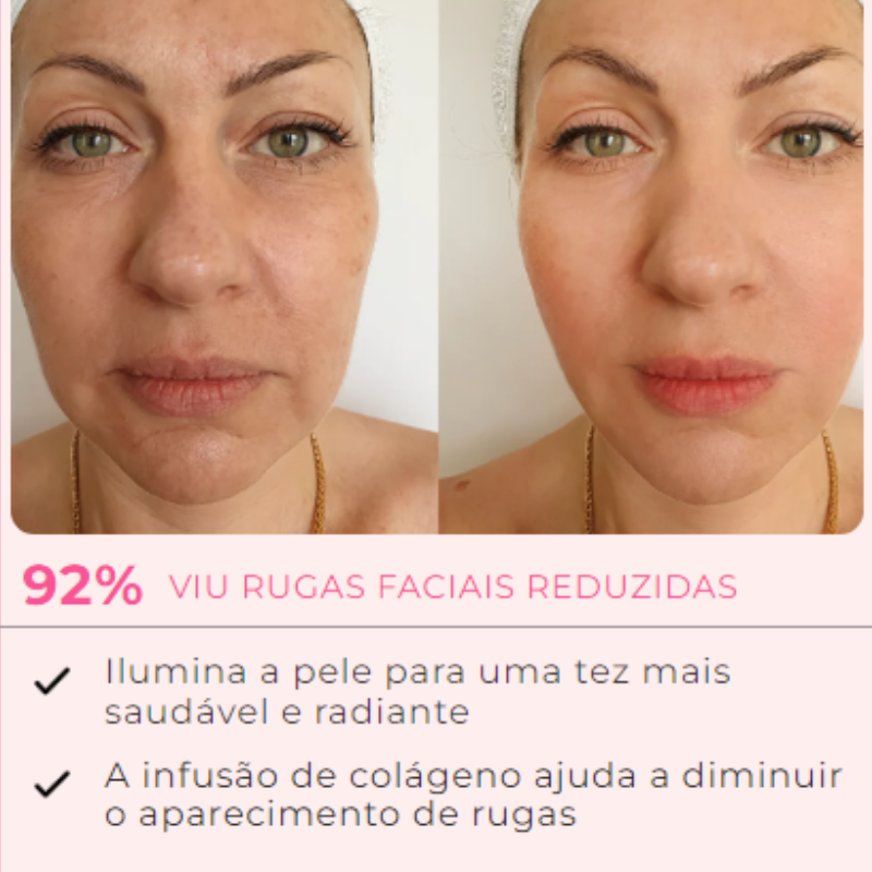 KIT RENEW 7 AMPOLAS + 1 APLICADOR DE BRINDE -  EFEITO BOTOX | Frete Grátis