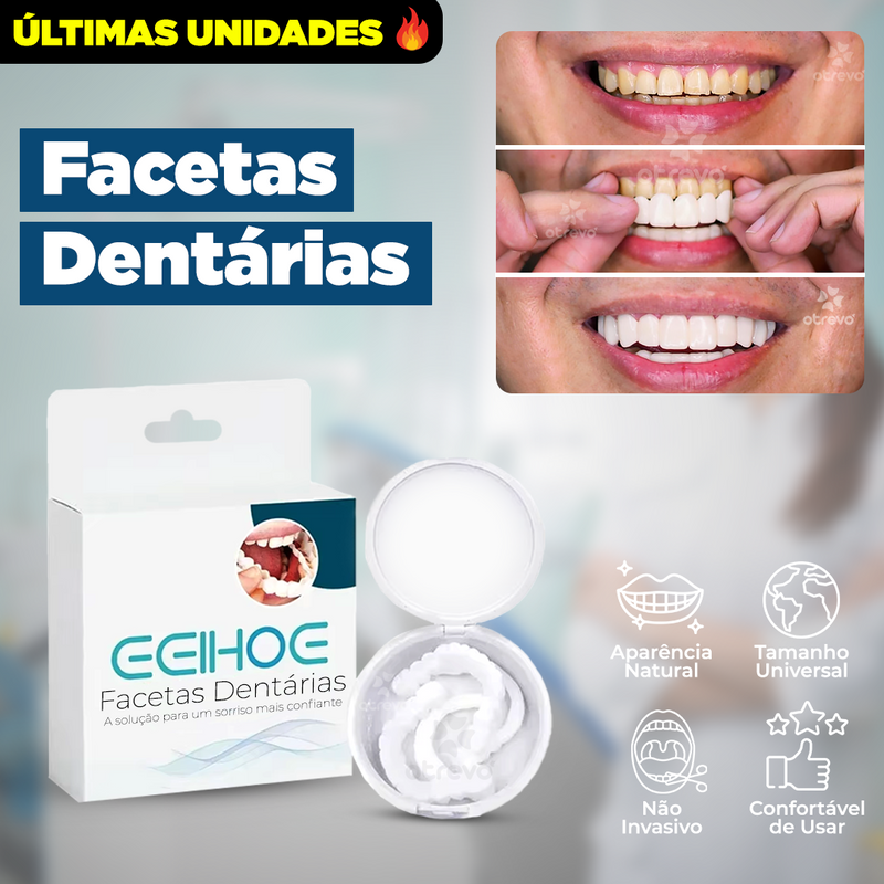 SmileFit® - Facetas Dentárias Naturais Removíveis